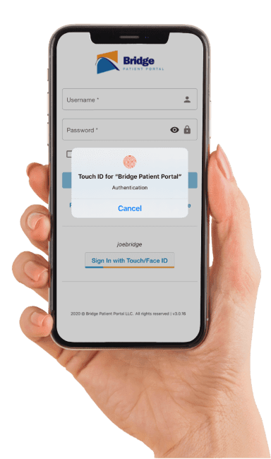 bridge blog thumbnail